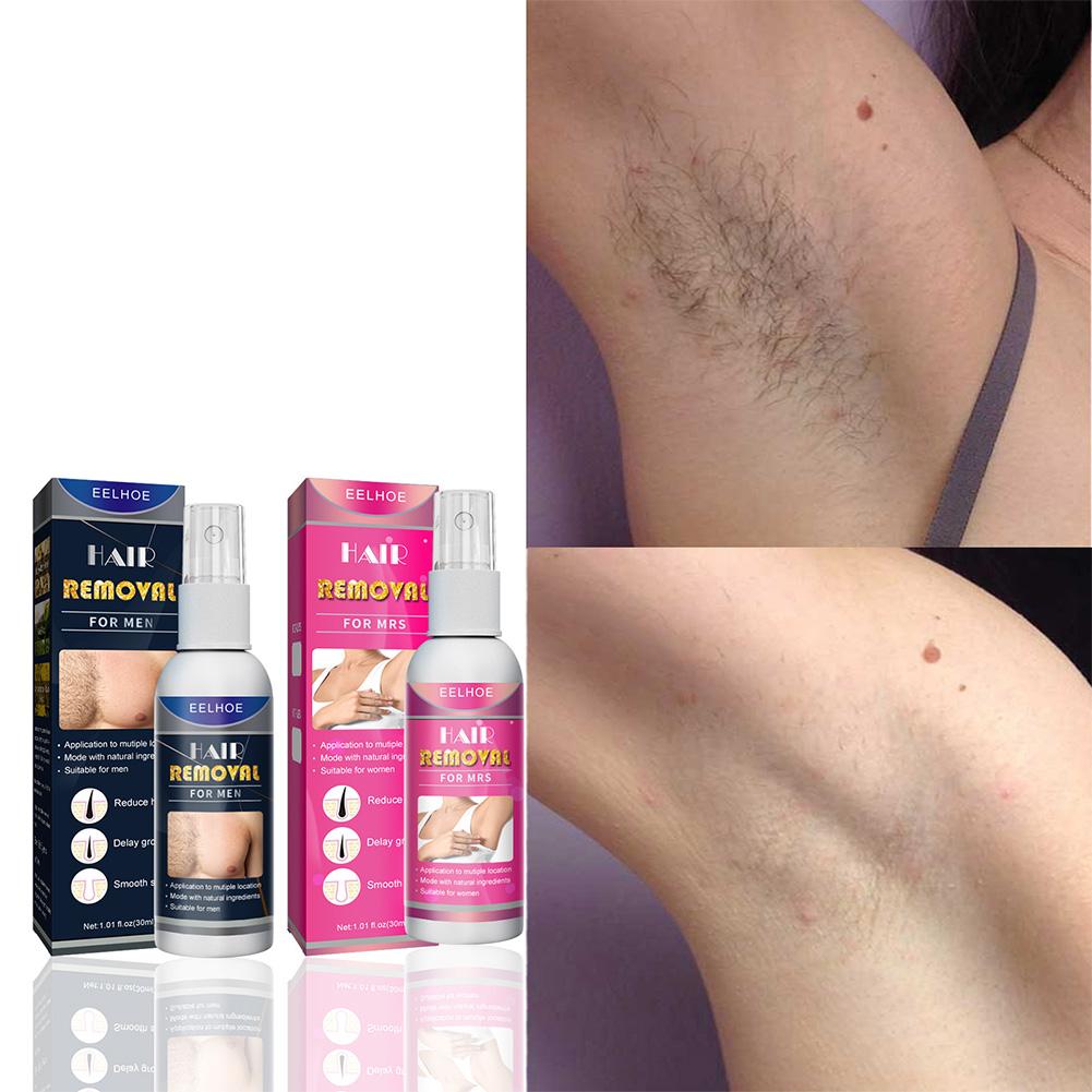 1/2PCS Super Natürliche Schmer – Hair Removal Cream Bewertung und Preis